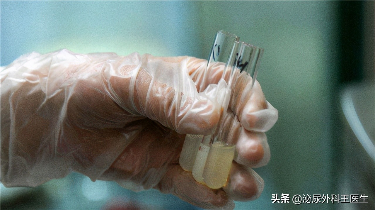 “一滴精等于十滴血”？这5个精液知识，夫妻都应知道