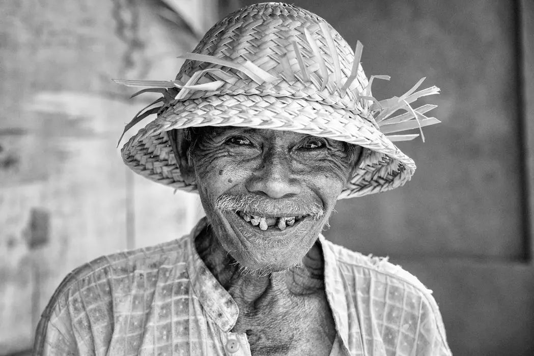 为什么有些洗牙很便宜,为什么洗牙价格差别那么大