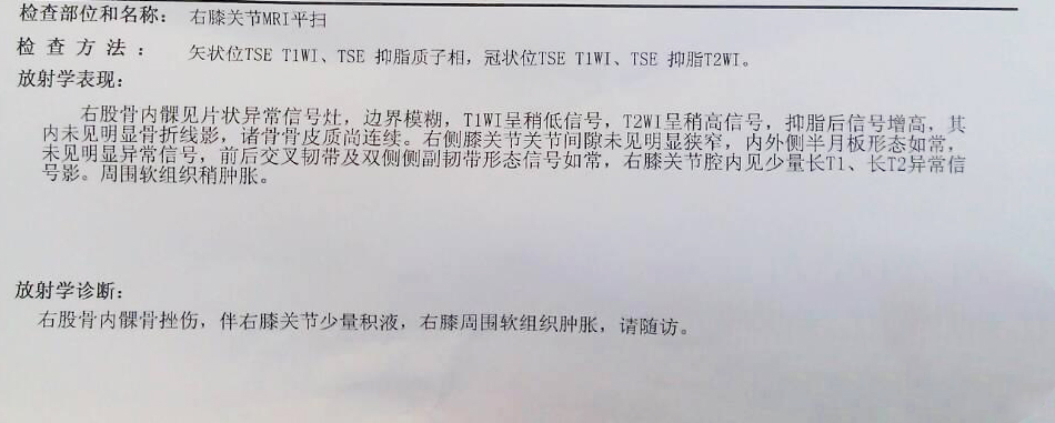怎样能看懂膝关节核磁图片,如何看懂膝关节磁共振报告