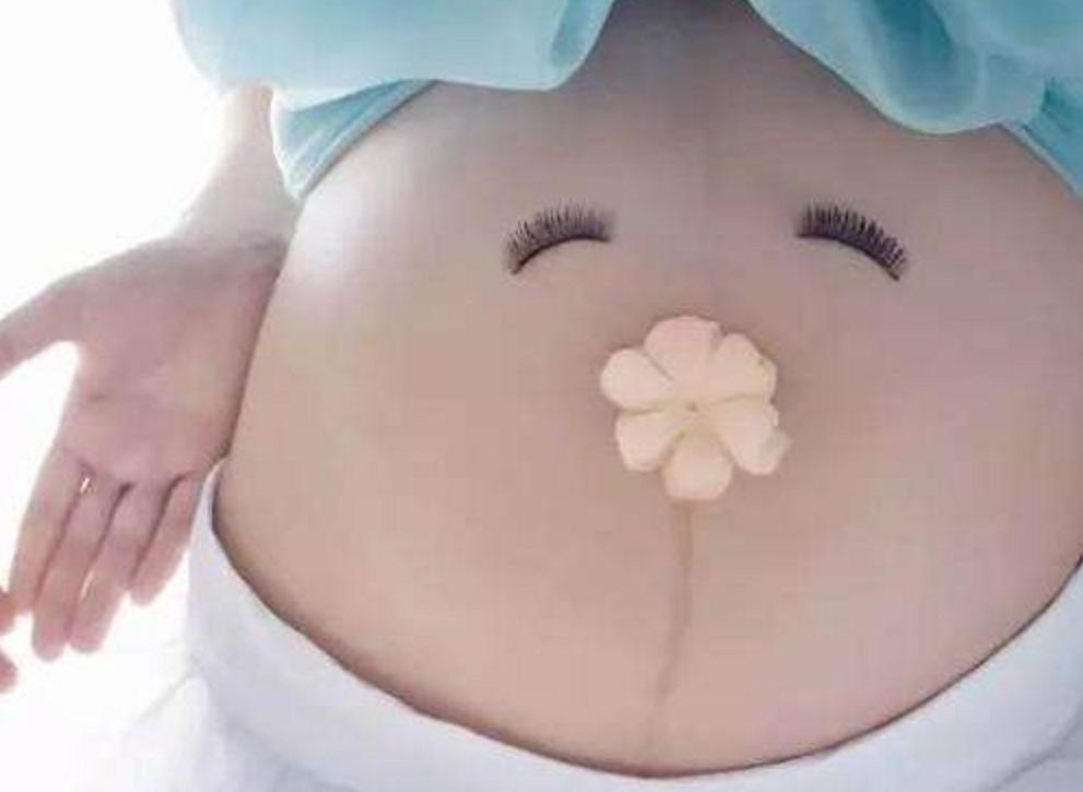 孕妈备皮想让老公代劳，不料护士却这样说，关于备皮你了解多少呢