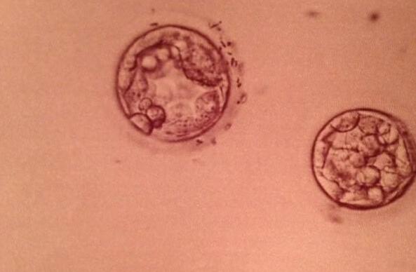 试管婴儿促排卵时注意事项,试管婴儿促排卵期间注意什么