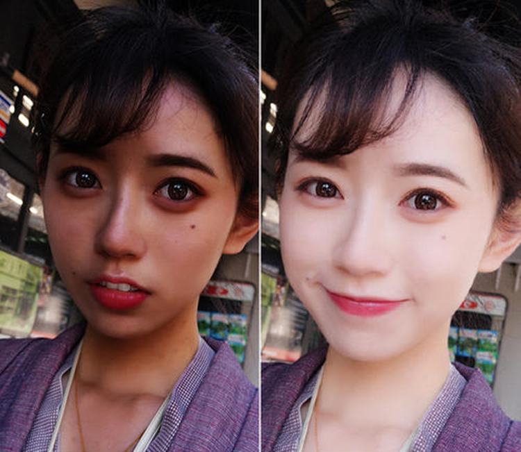 小孩被晒黑了怎么才能快速变白,男人皮肤晒黑了怎么快速变白