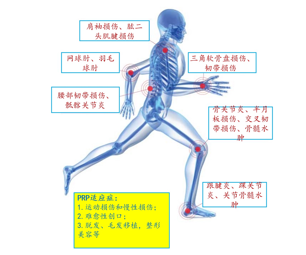 PRP治疗术——超级巨星也选择的的自体策划再生疗法