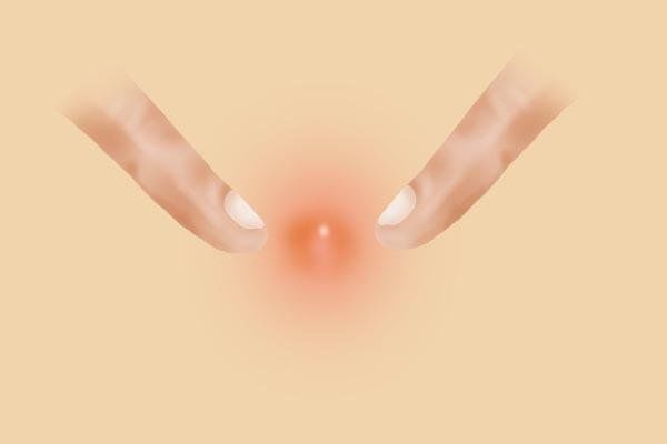 下巴上密密麻麻的小疙瘩是什么,脖子下巴长硬硬的疙瘩怎么回事