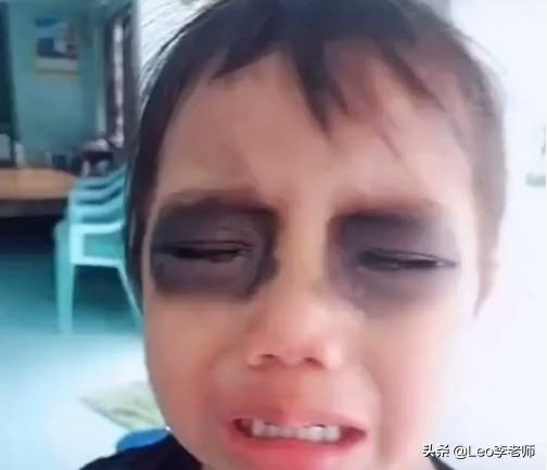 把孩子眼周围涂上眼影,制止孩子看手机给孩子眼睛画眼影