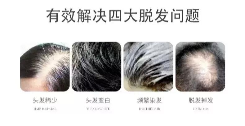 秃头小北鼻必备超自然的假发分享,所有发色都适合的假发