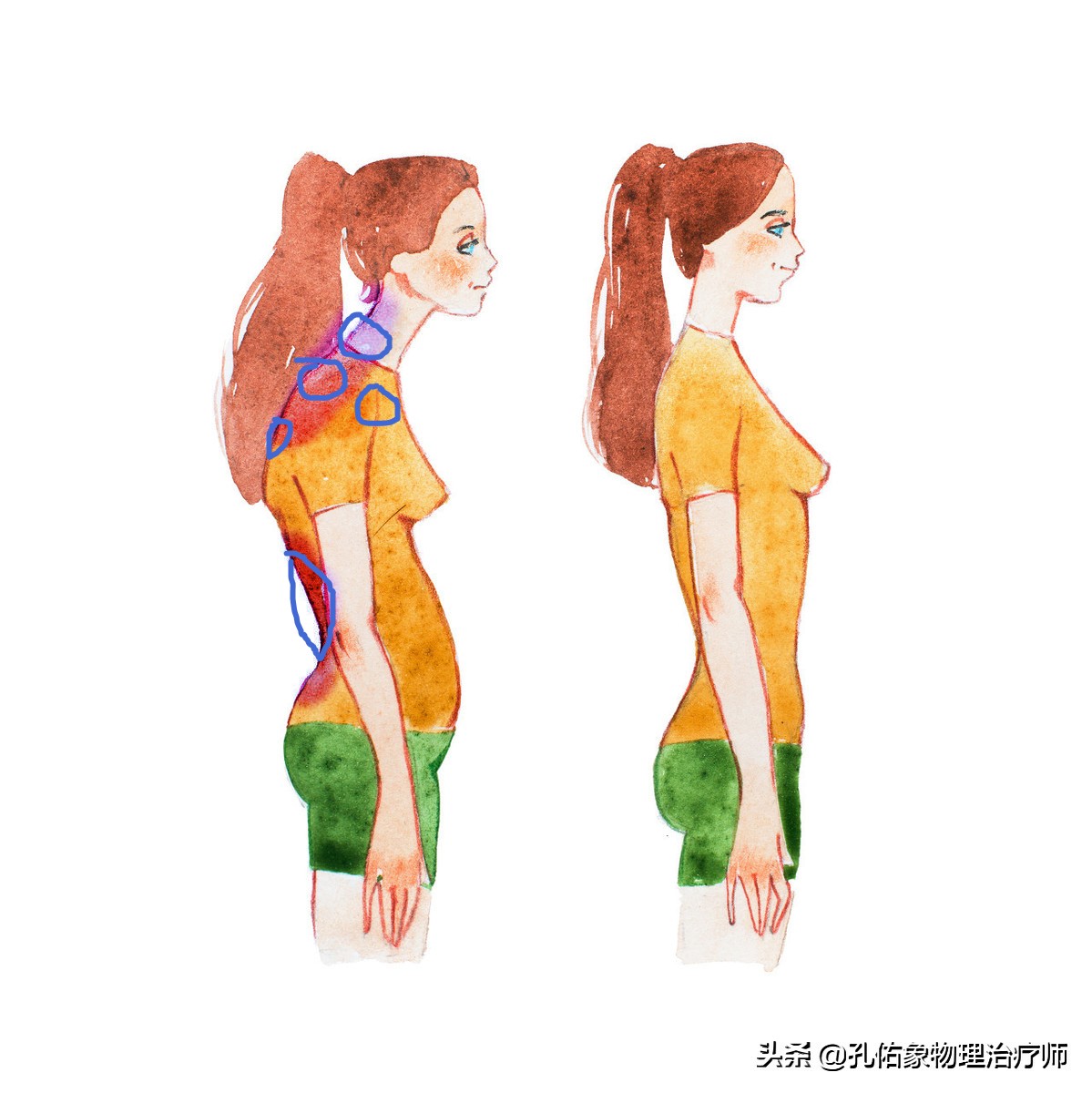 为什么颈部痛,颈肩部疼痛的康复治疗