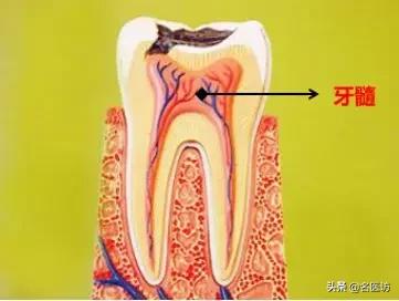 疫情期间牙痛怎么快速止疼,牙痛不是大病但痛起来要命