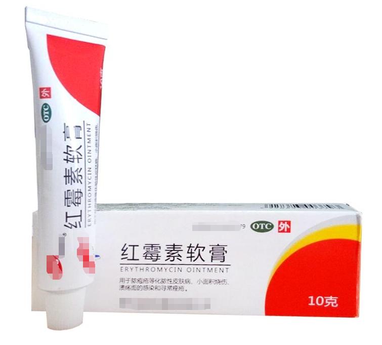 宝宝肉嘟嘟真可爱,宝宝脸蛋胖嘟嘟的原因