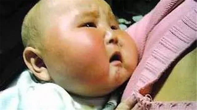 孩子喝到问题奶粉,喝奶粉宝宝脑袋变大事件