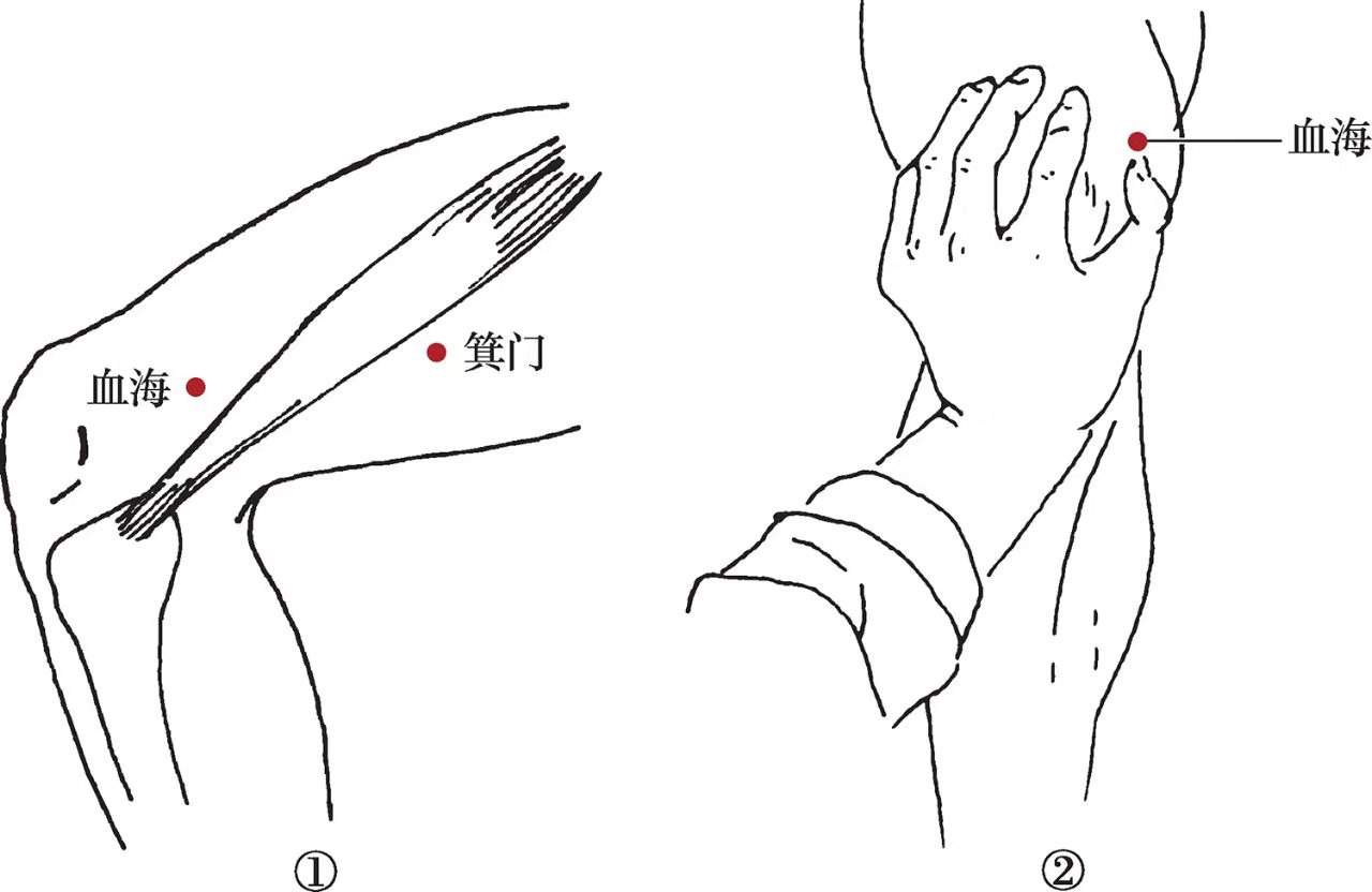 吕景山针灸治感冒视频,国医大学吕景山