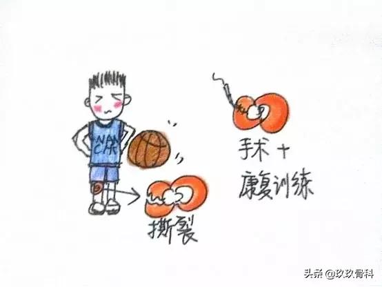 画说小哥哥膝盖疼是怎么回事？