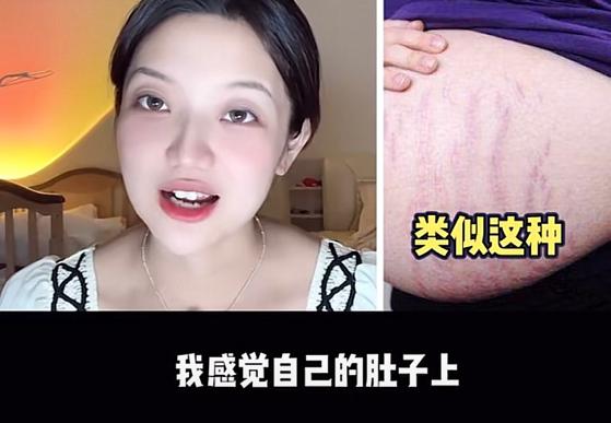 童星因鼻子变大遭网暴，本尊辟谣是怀孕的原因，肚子还全是妊娠纹