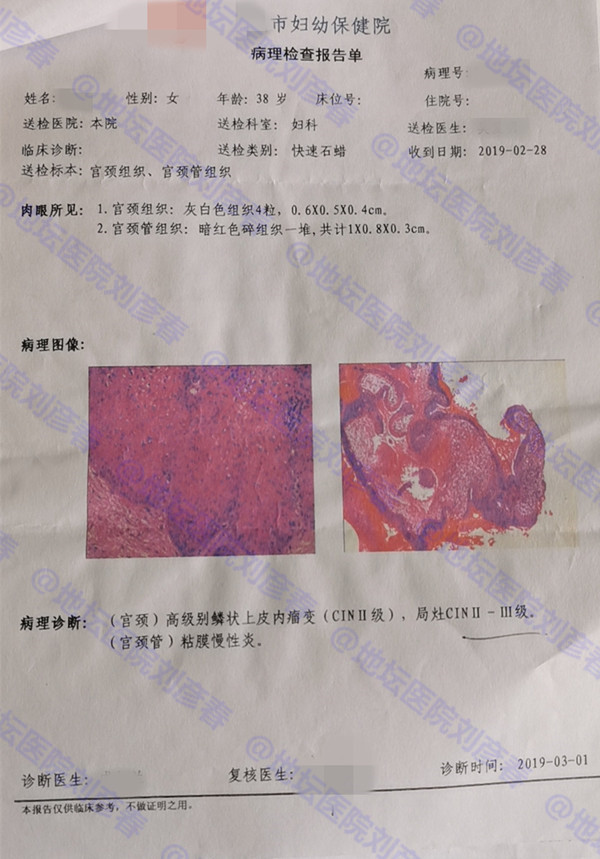 hpv感染多久会发生cin2级病变,hpv感染cin1病变塞药能好吗