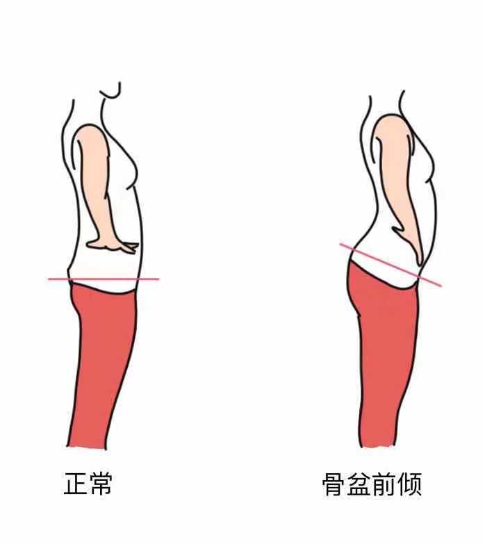 跑步后6个拉伸动作教你拉伸全身,跑步后胫骨前肌肉紧绷