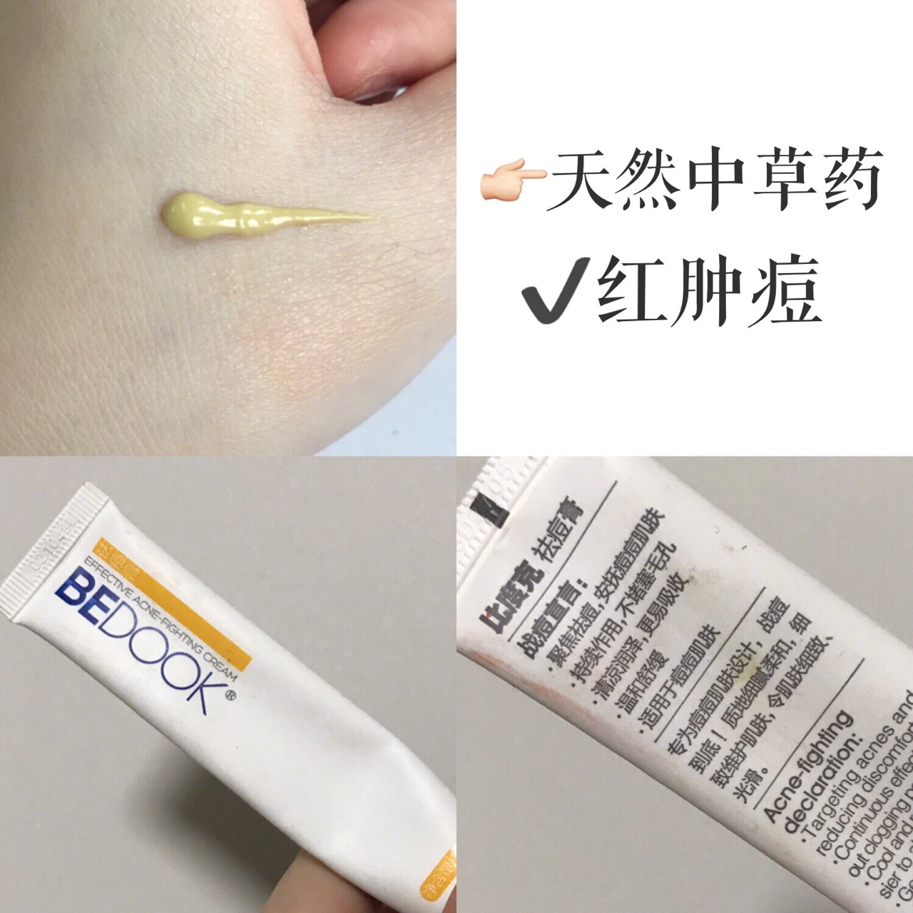 女孩子必用的祛痘神器,公认最好的祛痘药