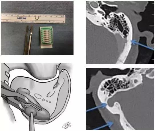 科普如何正确认识耳鸣,科普文的趣味性