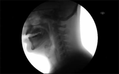 握手、亲吻、喝水、高跟鞋！X射线下人体的样子是啥样？