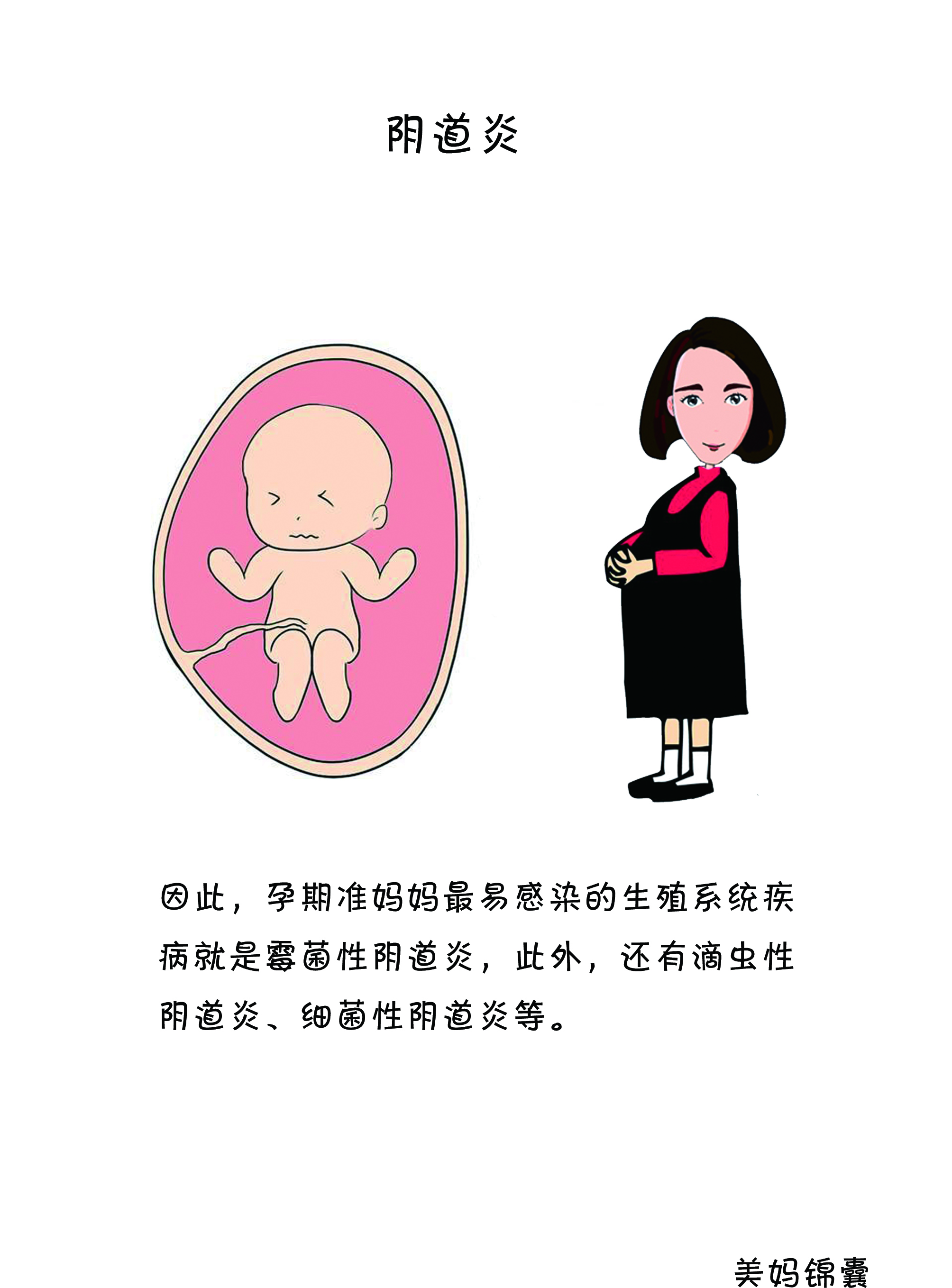 孕期阴道炎症状用什么药,孕期阴道炎症状怎么治疗