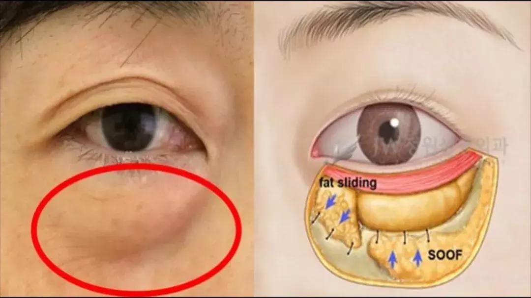 眼霜如何挑选先来看看这篇干货,眼霜推荐排行榜第一名怎么选