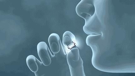 胶囊机器人胃镜设备多少钱,我国5g胃镜胶囊机器人视频