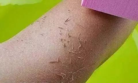 洗澡时搓下来的泥是什么？在显微镜下放大一百倍，看后让人不舒服