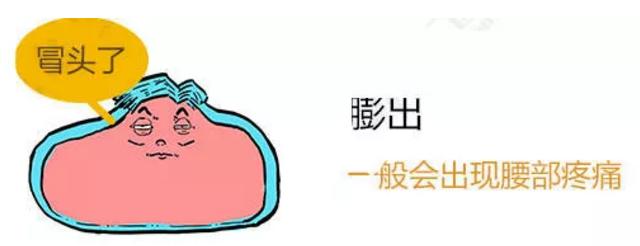 此文章让你彻底明白什么是：腰间盘突出