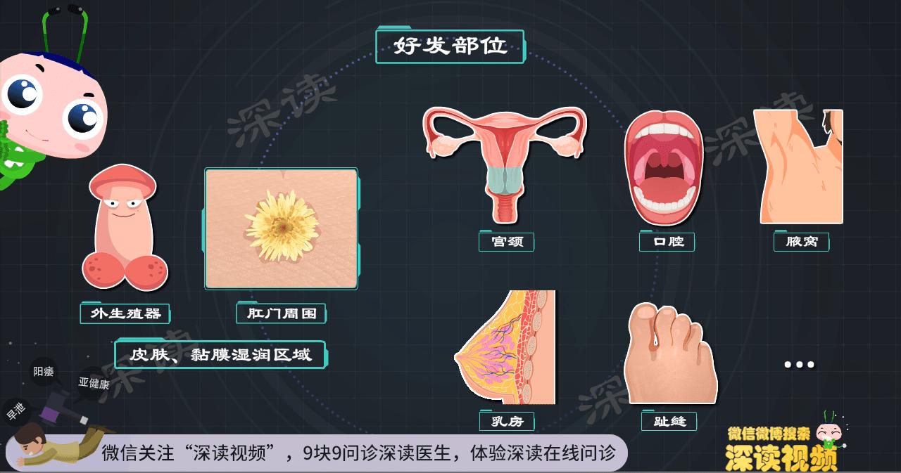 小伙子长了湿疣,一男性查出hpv长疣体