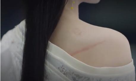 疤痕的6个误区你知道真相吗,关于疤痕了解的误区