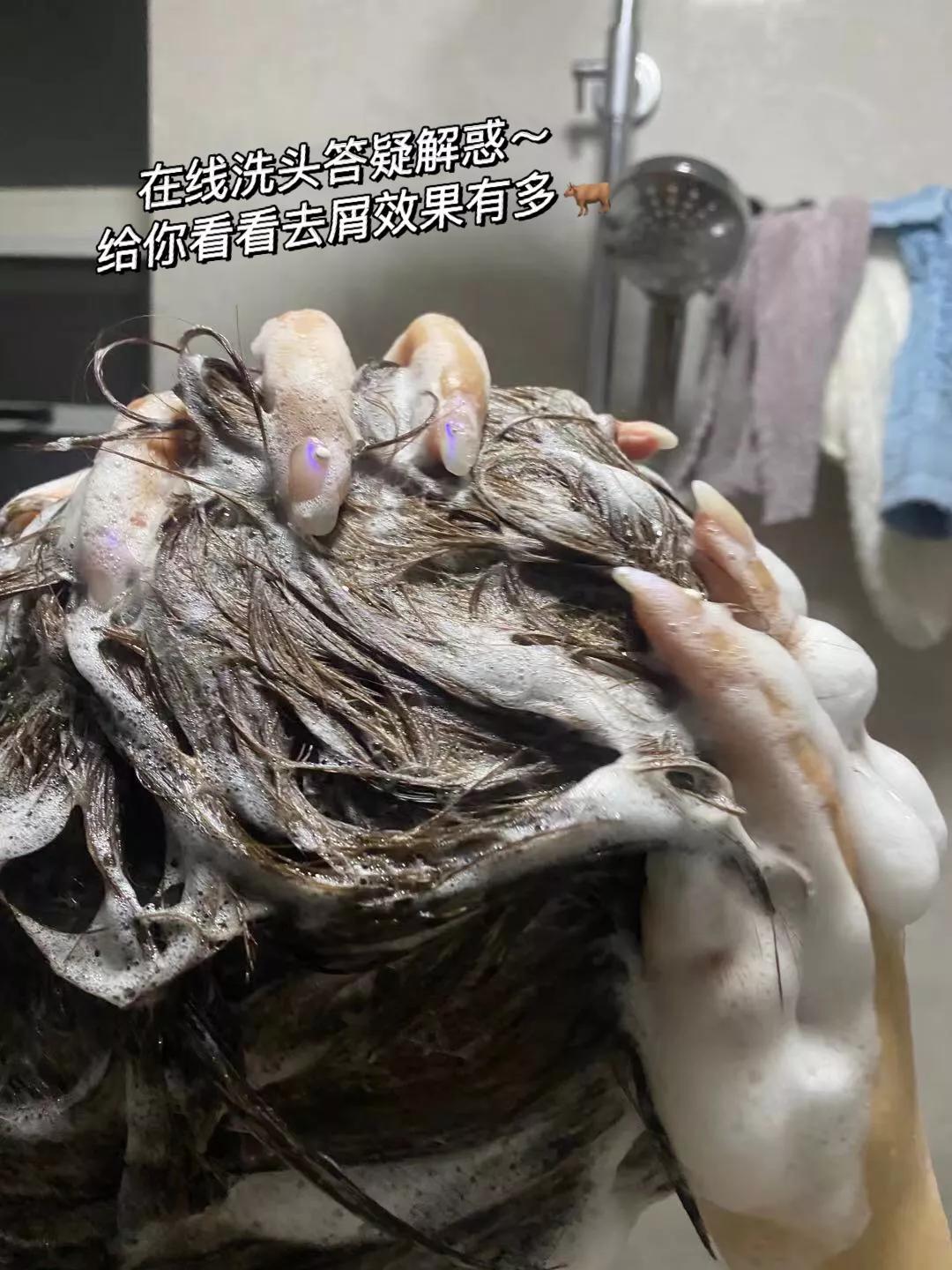 为什么从来没有头屑,你还在为头屑而烦恼吗