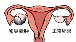 关爱女性健康妇科疾病患者实例,导致女性妇科疾病的根源是什么