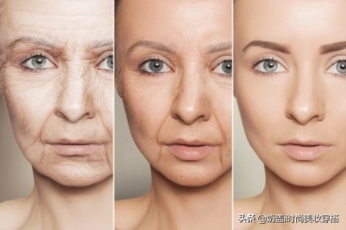 胡兵教的祛除法令纹的动作,什么瑜伽动作改善面部法令纹