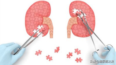 糖尿病肾病治疗的中成药是什么,适合糖尿病肾病吃的中成药有哪些