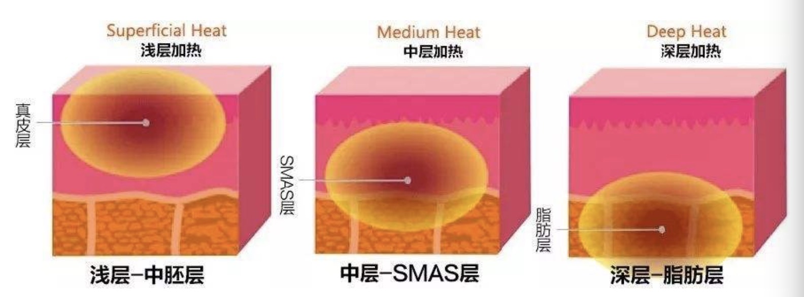 热拉提维持时间短为什么还在用,热拉提普通版有必要做吗