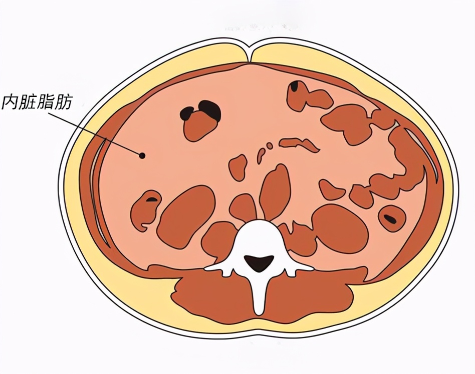 怎么减内脏脂肪正确方法,内脏脂肪怎么减掉最有效的方法