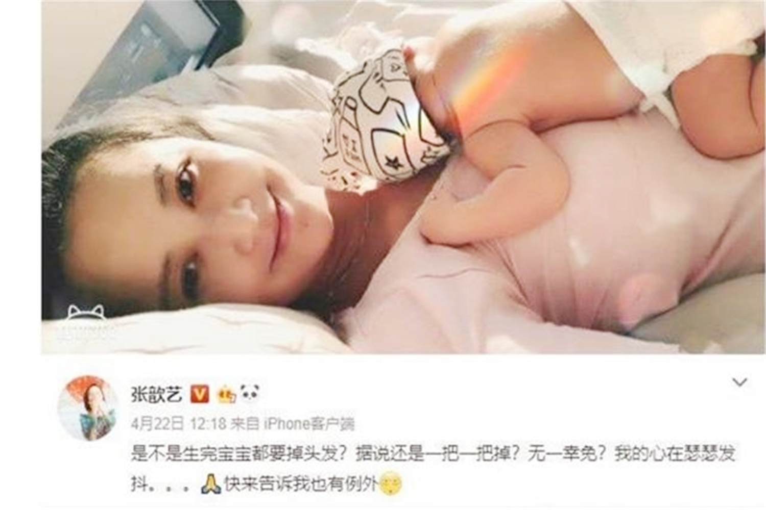 张歆艺产后掉发,张歆艺产后脱发