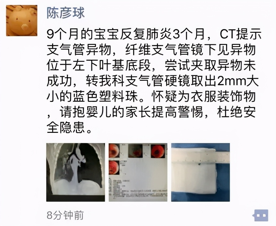 儿童劣质衣服对身体有害吗,劣质童装危害新闻