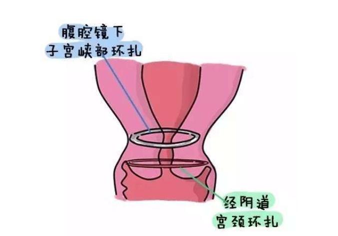 世上最难的职业——孩子妈，31岁妈妈怀孕5次终得女