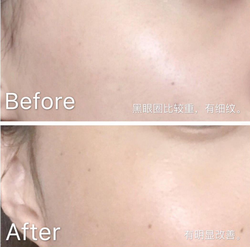 眼霜如何挑选先来看看这篇干货,眼霜推荐排行榜第一名怎么选