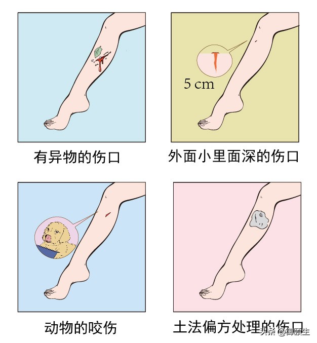 春假出游，磕碰受伤需打碎伤风吗？四种情况最易感染，危及生命