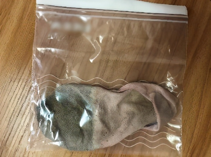 20岁小伙脚臭,25岁帅哥脚臭怎么办