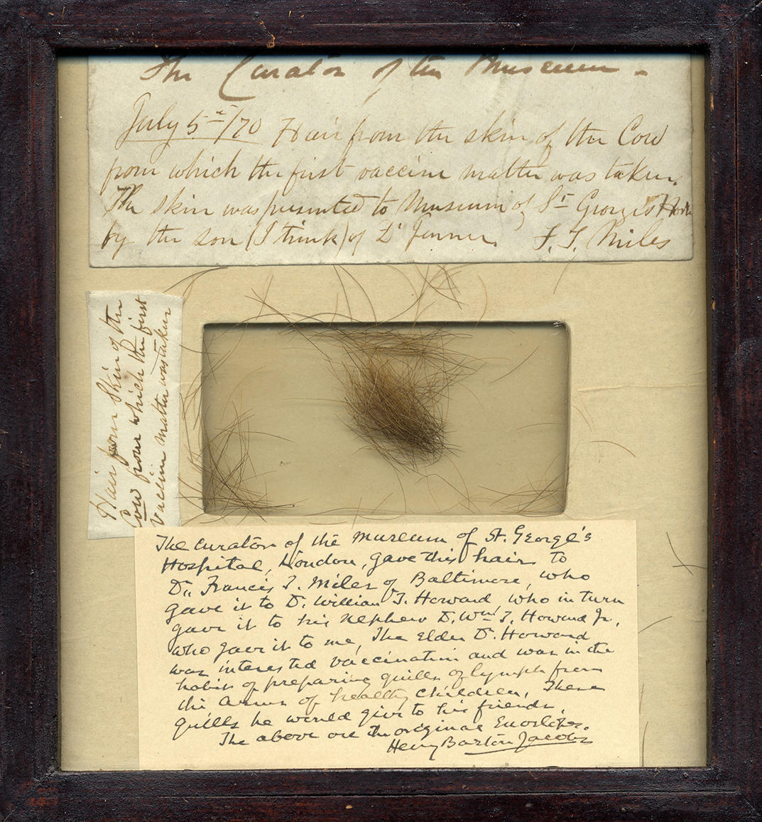 免疫学之父爱德华詹纳治疗天花,免疫学之父爱德华詹纳