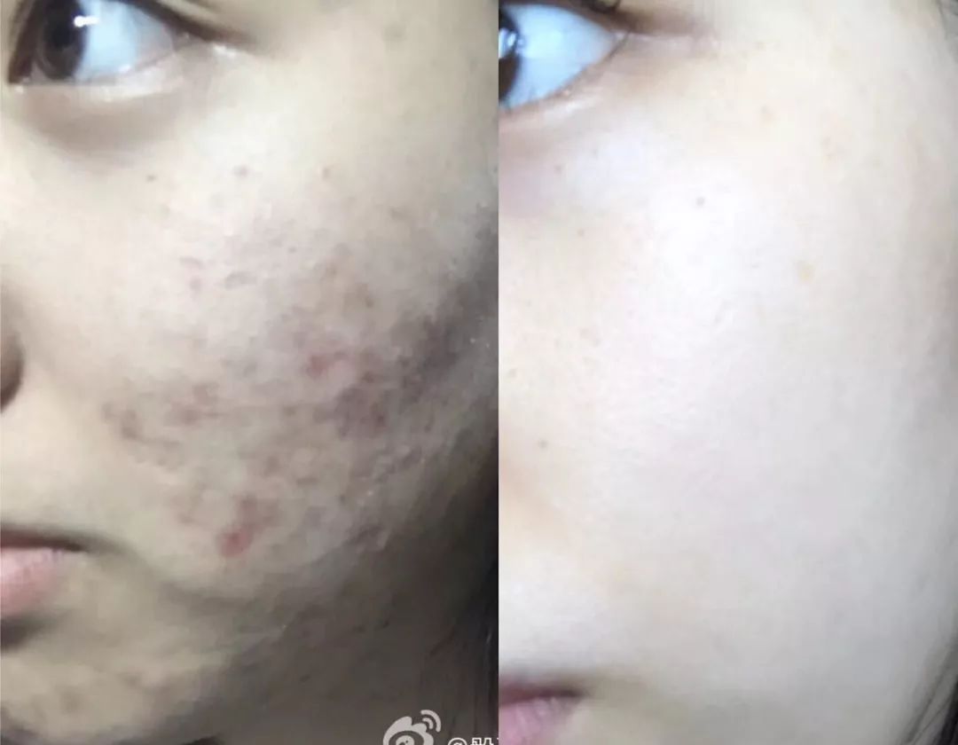 欧莱雅算不算欺诈消费,欧莱雅虚假宣传罚款多少