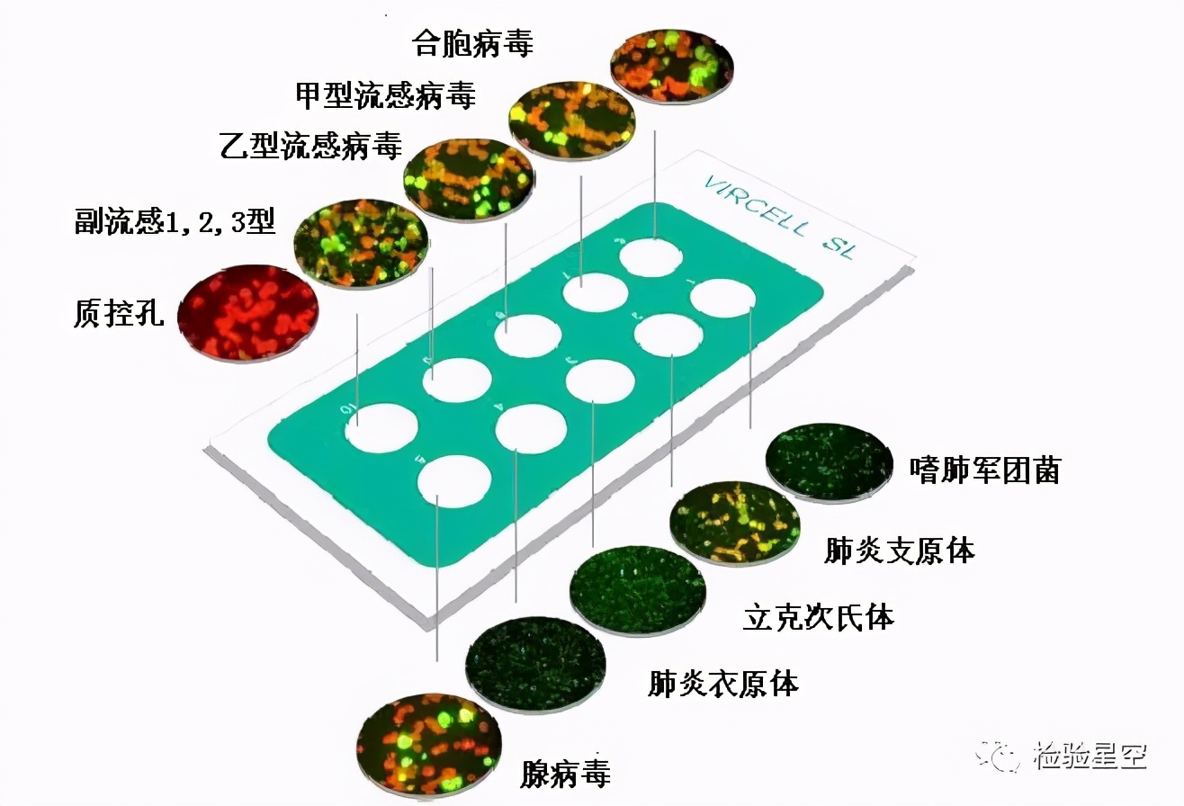 呼吸道病原体九联检结果怎么看,呼吸道九联检是用啥管子