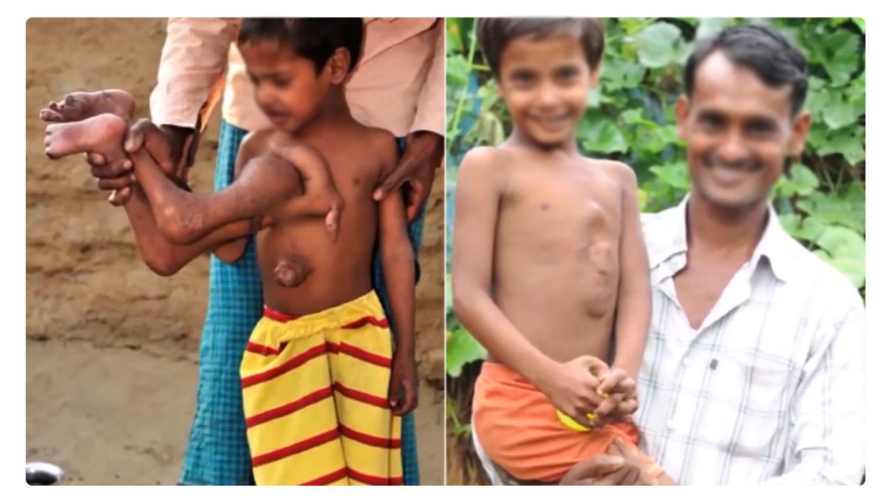 全世界最聪明的小孩智商是多少,世界十个天生奇异的孩子