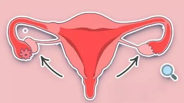 怎么区分黄体破裂和其他腹痛症状,黄体破裂腹痛减轻了还用去医院吗