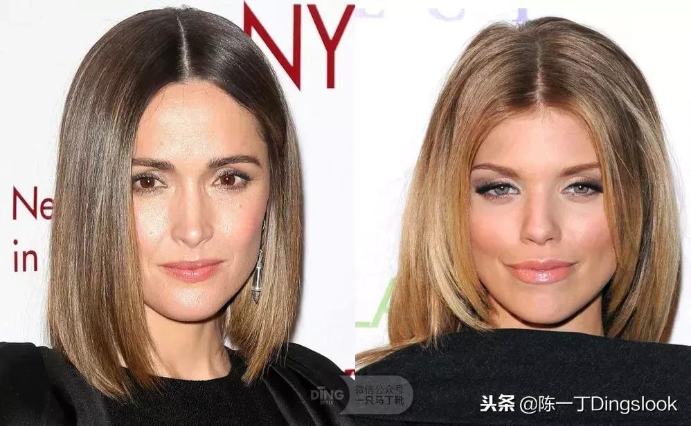 颧骨高太阳穴凹陷怎么改善脸型,颧骨宽大太阳穴凹陷快速改善