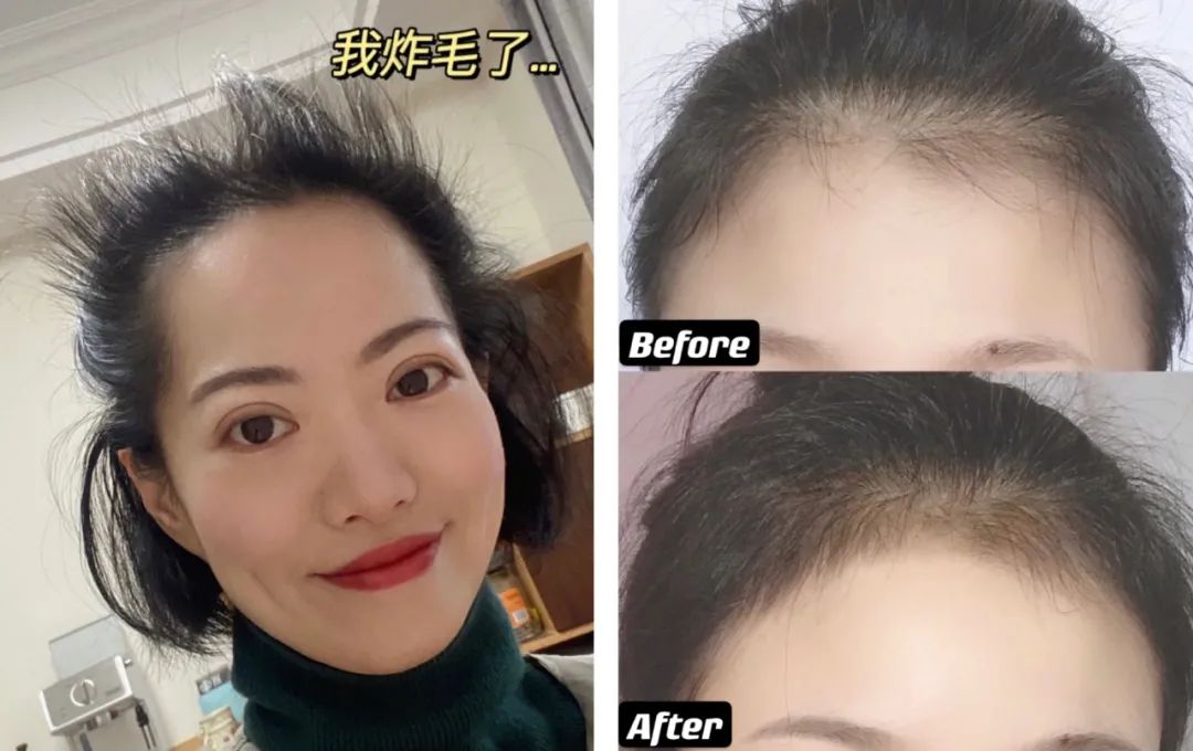 哪一款刘海好看适合所有脸型,减龄发型适合所有脸型有刘海