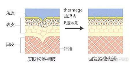 BOZ宝致|抗衰干货！我希望等到60岁依然是你们眼中的小可爱