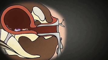 我用七次流产，换来这条血的教训